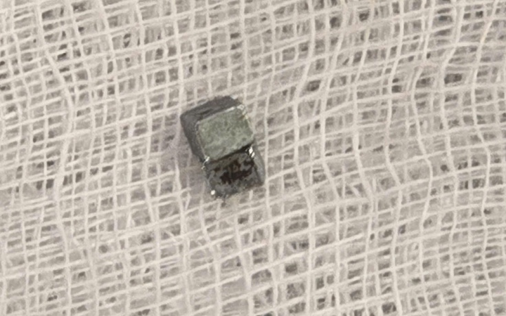 Bé trai 5 tuổi ho, đau họng, đi khám phát hiện nuốt 7 viên nam châm