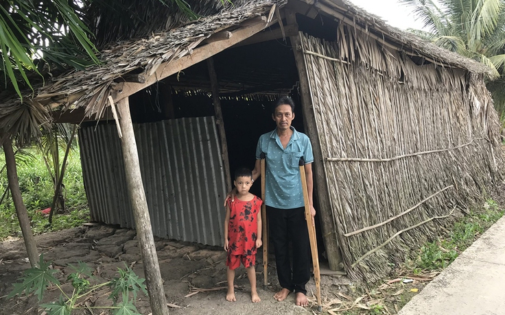 Bị hoại tử chỏm xương đùi, người đàn ông nghèo mong được giúp đỡ