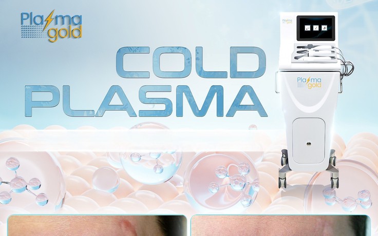 Chuyên gia bất ngờ ứng dụng của Plasma lạnh hiệu quả sau 1 liệu trình