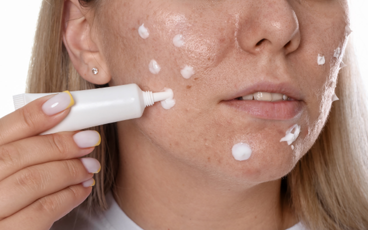 Vì sao nhiều người trị sẹo mãi không hiệu quả dù rất chăm skincare?