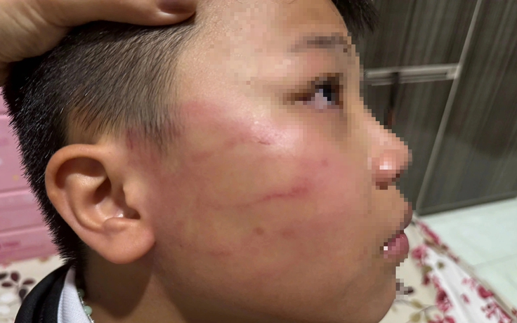 Thầy giáo người Ấn Độ tát học sinh lớp 4: Kiểm tra việc dạy thêm không phép