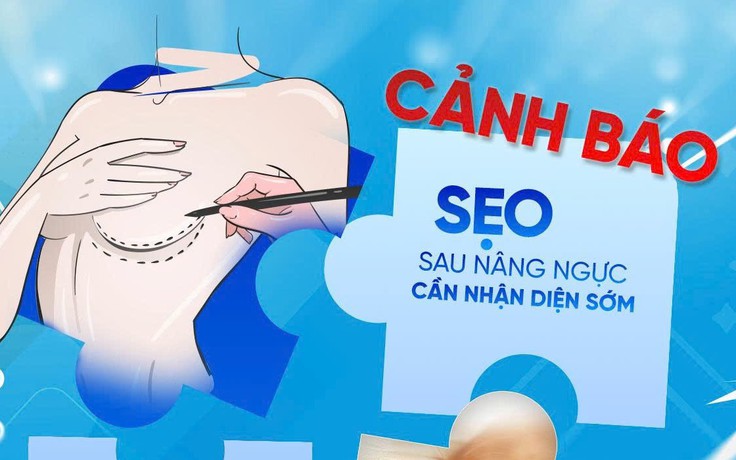 Phẫu thuật thẩm mỹ ngực: Đừng để hành trình tìm lại tự tin ‘đứt gánh’ vì sẹo