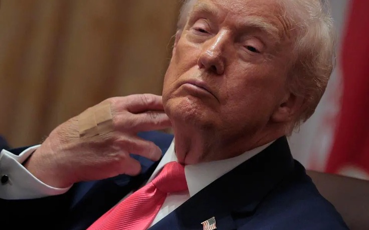 Bác sĩ của ông Trump nói gì sau đợt kiểm tra sức khỏe?