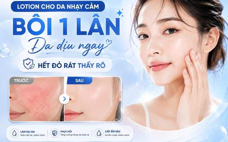 Lotion cho da nhạy cảm: Bôi 1 lần, giúp làm dịu da, giảm đỏ rát thấy rõ