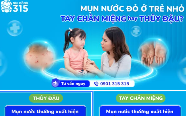 Làm sao phân biệt mụn nước và thủy đậu?