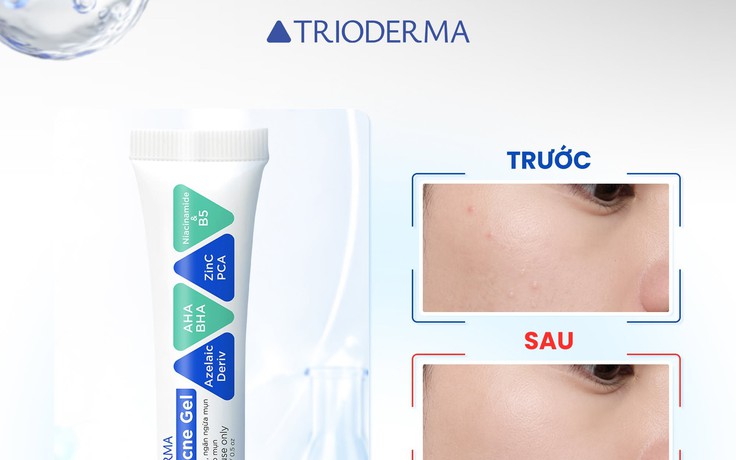 Review kem chấm mụn Trioderma Anti Acne Gel có tốt không mà luôn hết hàng?
