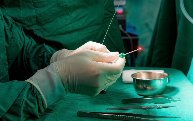 Triệt tiêu búi trĩ bằng công nghệ Laser Diode không dùng dao mổ tại Đà Lạt