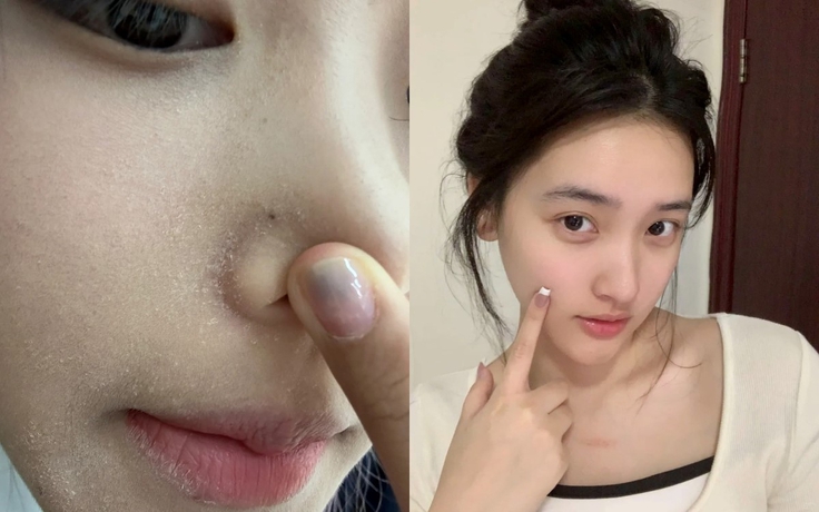Top 8 sữa rửa mặt cho da khô căng mượt glowy giúp ngăn ngừa lão hóa sớm