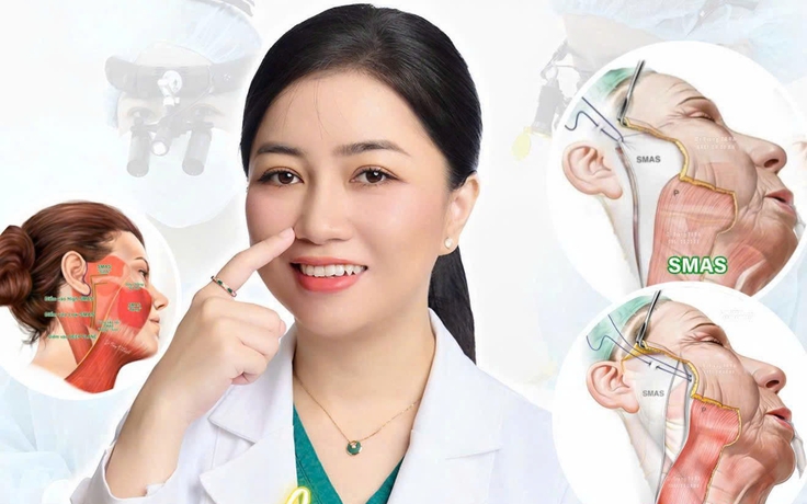 Căng da mặt Deep Plane là gì? Hiểu đúng và áp dụng hiệu quả