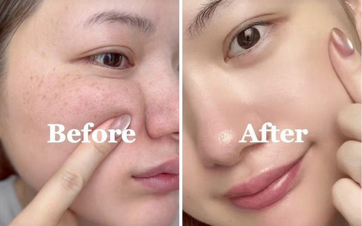 +7 kem mờ nám đậm màu 2 bên gò má đang cháy hàng, muốn mua cũng khó