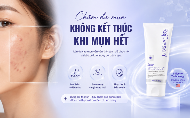 Chăm da mụn không kết thúc khi mụn hết
