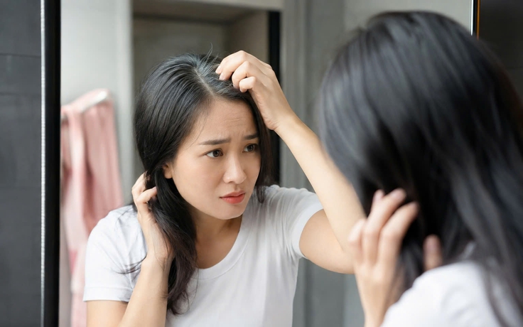 Tóc bạc trước tuổi 35: Những nguyên nhân ít ai ngờ