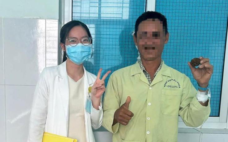 Sỏi gần 100 gram 'ẩn mình' trong cơ thể người đàn ông suốt 20 năm