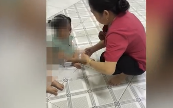 Sở GD-ĐT TP.HCM lên tiếng vụ cô giáo bắn dây thun vào chân trẻ