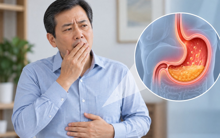 Ợ hơi thường xuyên: Khi nào cần đi khám, có phải dấu hiệu ung thư?
