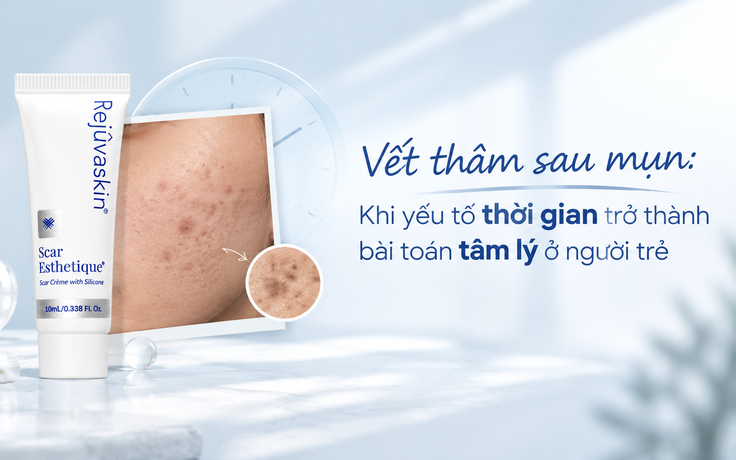 Vết thâm sau mụn: Khi yếu tố thời gian trở thành bài toán tâm lý ở người trẻ