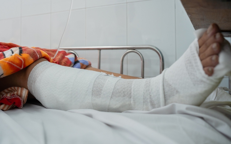 Sức khỏe người phụ nữ bị cây ngã đè bị thương nặng ở TP.HCM