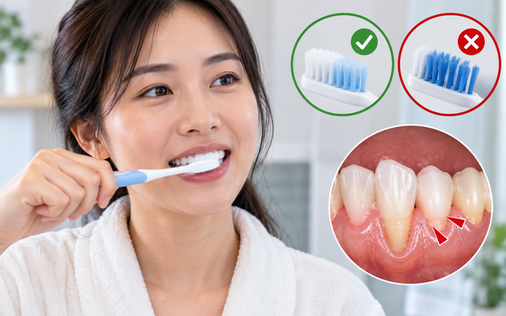 6 lỗi khi đánh răng có thể hại răng, tổn thương nướu