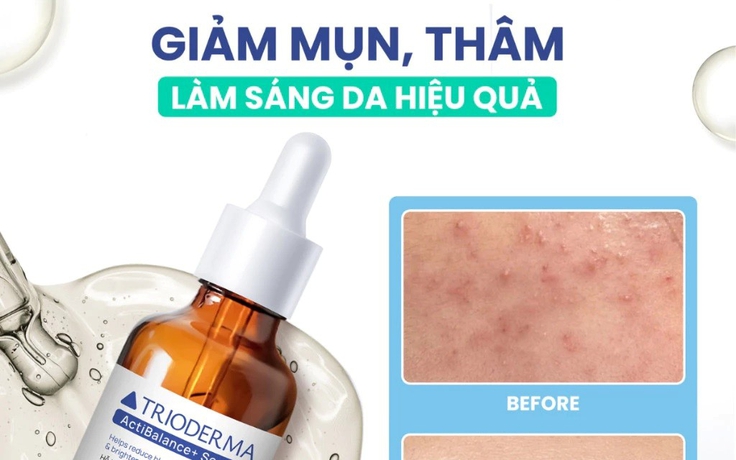 Serum giúp ngừa mụn, sáng da Trioderma ActiBalance+ Serum có tốt không mà ‘cháy hàng’ liên tục? Serum giúp ngừa mụn, sáng da Trioderma ActiBalance+ Serum có tốt không mà ‘cháy hàng’ liên tục?