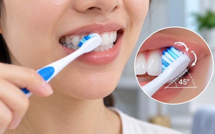 Nha sĩ chỉ ra lỗi nhiều người mắc khi đánh răng