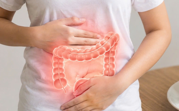 Thói quen giúp giảm nguy cơ ung thư đại tràng
