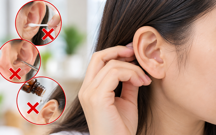 Bác sĩ: Người bình thường không cần lấy ráy tai theo lịch cố định