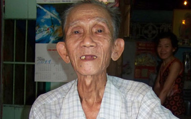 79 tuổi mới biết tim mình nằm bên phải