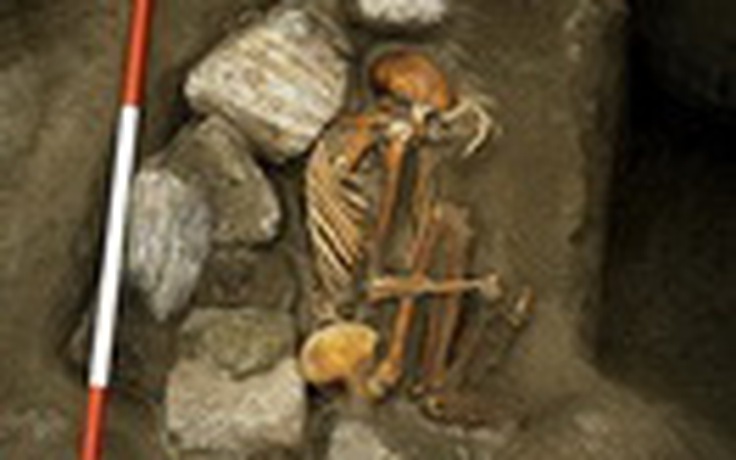 Bí ẩn xác ướp "Frankenstein" 3.000 tuổi