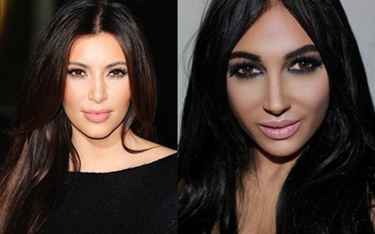 Fan cuồng chi 700 triệu phẫu thuật để giống Kim Kardashian
