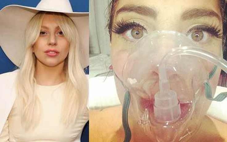Lady Gaga tung ảnh nhập viện vì say độ cao