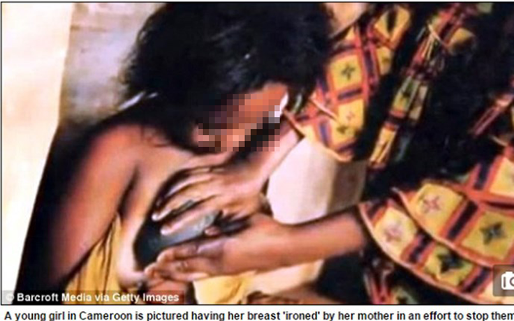 Hủ tục ủi ngực để chống hiếp dâm ở châu Phi