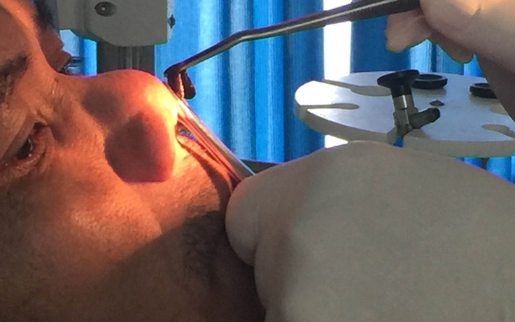 Con đỉa dài 6 cm sống trong mũi một bệnh nhân