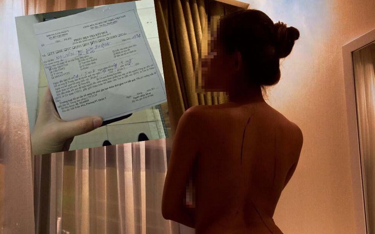 Không khởi tố vụ người mẫu ảnh nude tố bị họa sĩ hiếp dâm