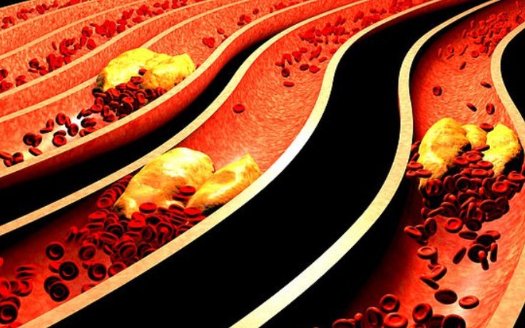 Cách ăn đặc biệt giảm đến 52% mức cholesterol xấu chỉ sau vài tuần Cách ăn đặc biệt giảm đến 52% mức cholesterol xấu chỉ sau vài tuần