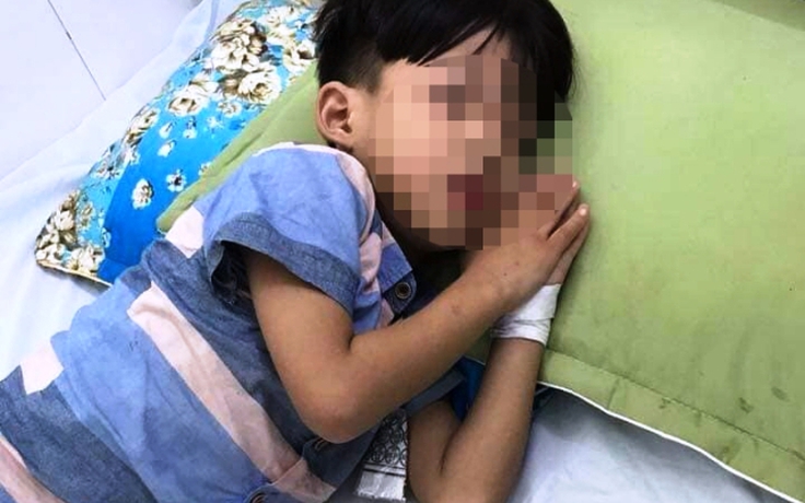 Bé trai 5 tuổi chết sau 1 tháng bị chó cắn nhưng không phải do bệnh dại