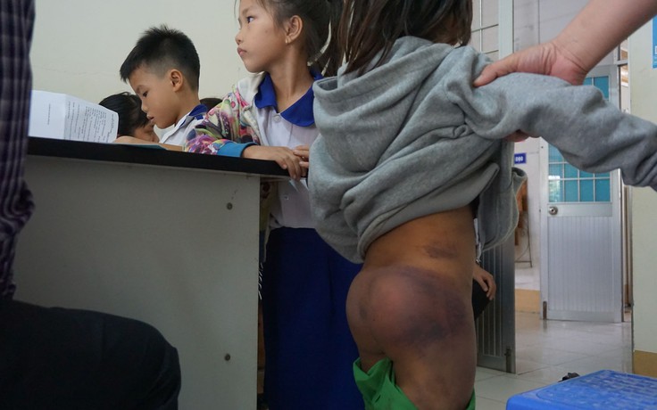 Nghi vấn 4 học sinh tiểu học ở Cà Mau bị người thân bạo hành