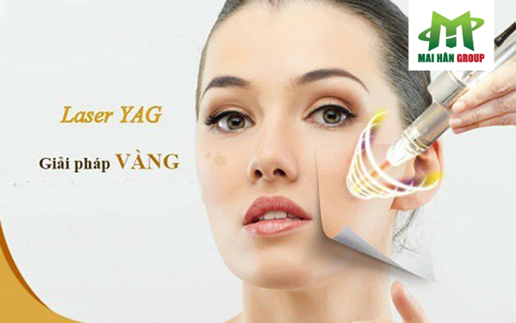 Sạch nám sáng da với công nghệ Laser Nd Yag