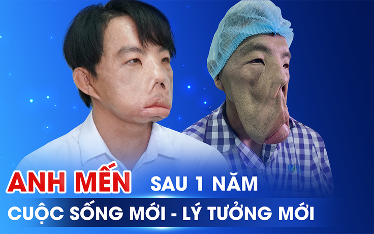 Bệnh nhân mặt biến dạng gây chấn động cộng đồng sau 1 năm phẫu thuật thẩm mỹ