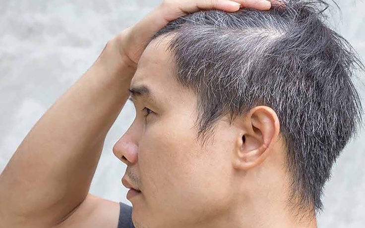 Sắc mun - dầu gội phủ bạc giúp tóc đen bóng trở lại