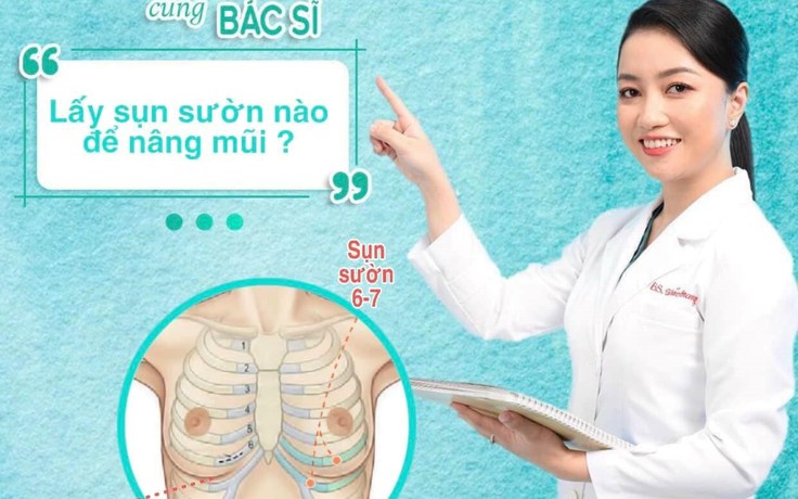 Nâng mũi sụn sườn cho những chiếc mũi mới nên hay không nên?