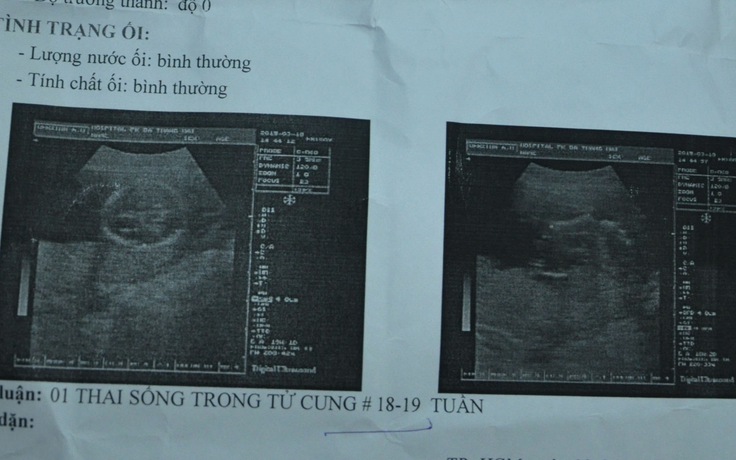 Tỷ lệ phá thai ở mức cao, mất cân bằng giới tính