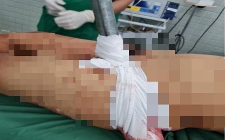 Nam thanh niên ở Long An bị ống sắt lan can cầu đâm xuyên bẹn
