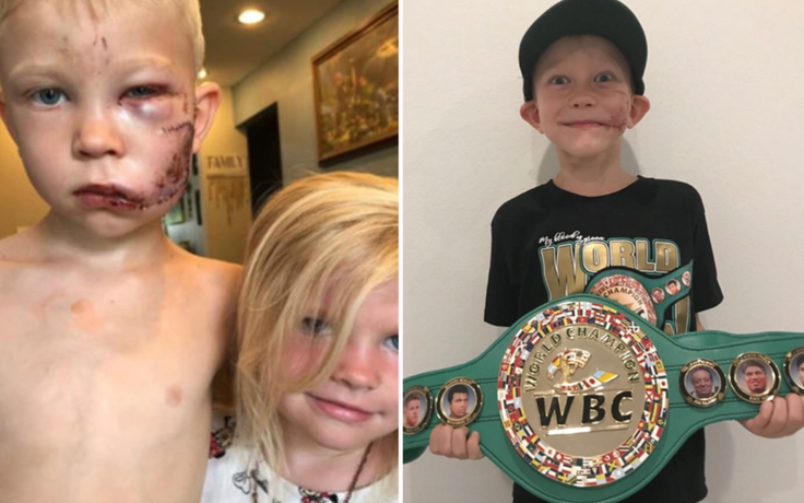 WBC ra mắt hạng cân ‘Bridger’ vì cậu bé 6 tuổi cứu em gái khỏi chó dữ