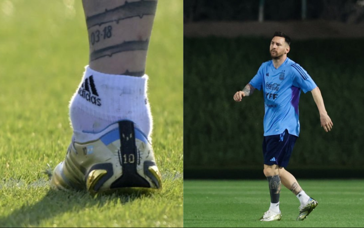 Hình ảnh mắt cá chân sưng to bất thường của Messi khiến người hâm mộ lo lắng