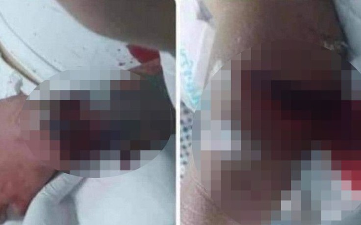 Thái Bình: Khởi tố nam thanh niên dùng dao chém bố và cậu ruột của bạn gái