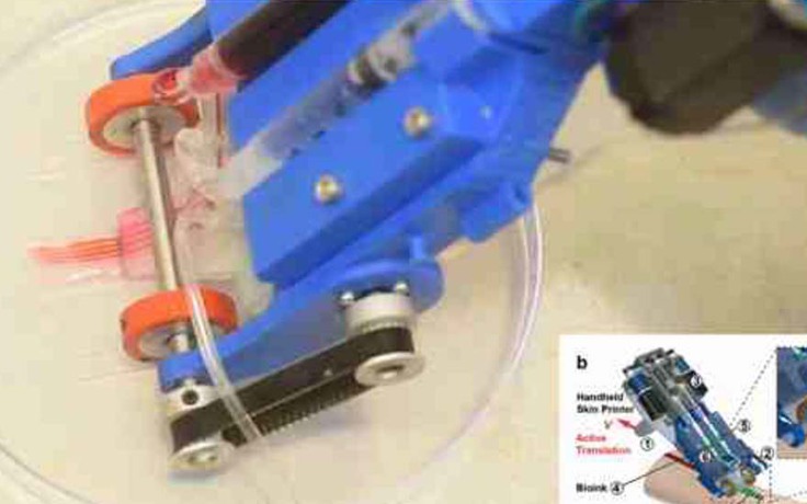 Phát minh mới: 'Súng bắn keo' in da 3D giúp điều trị vết thương nặng trong 2 phút