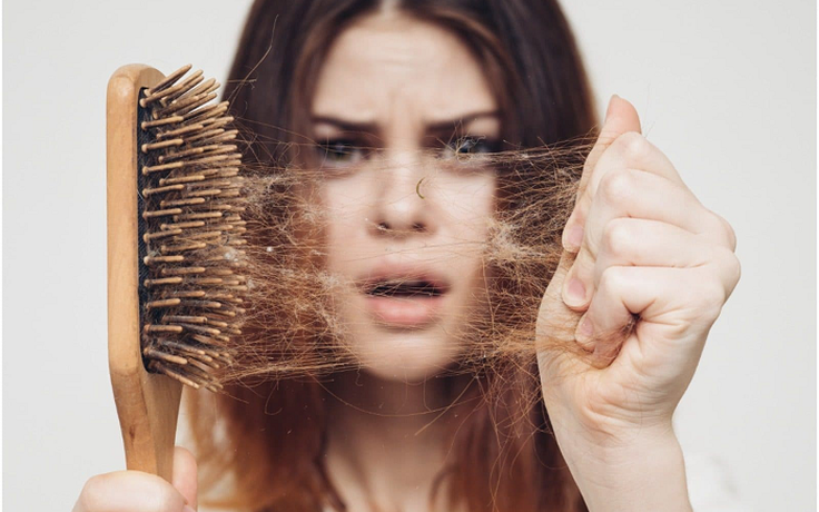 Cách khắc phục hiệu quả rụng tóc hói đầu