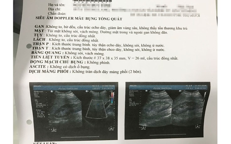 Gan nhiễm mỡ là gì mà sao ai khám sức khỏe cũng 'dính'?