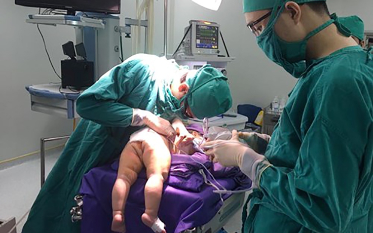 Phẫu thuật cho bé sơ sinh không có mông, hậu môn