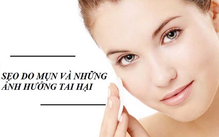 Sau mụn thường để lại sẹo gì? Làm thế nào để ngăn ngừa sẹo mụn?